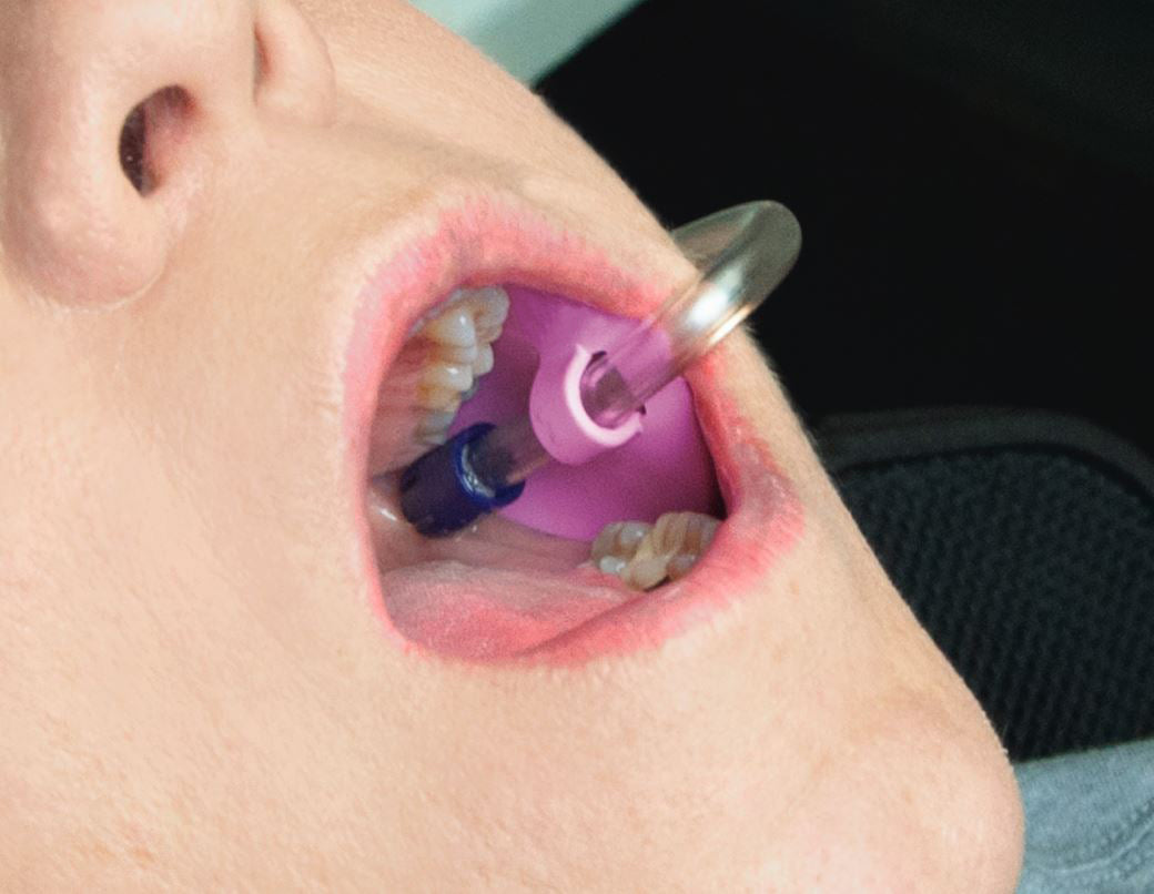 Saliva Ejector Holder, 50pcs/bag, 992763 numedical